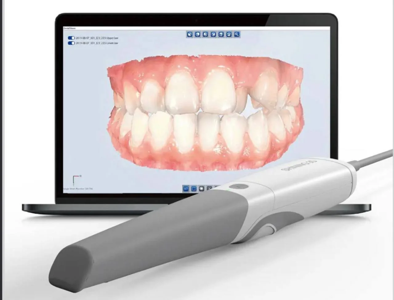 Panda intraoral scanner